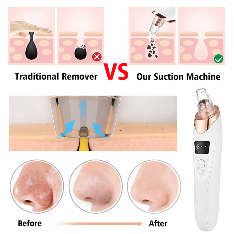 پک فیشیال | اتوصورت + میکرودرم + ماساژور صورت+ بخور سرد شارژی